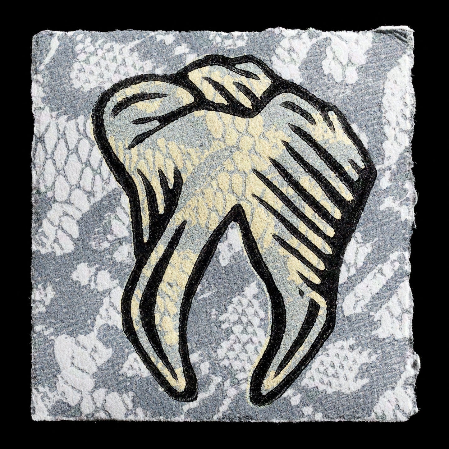 This captivating relief print, 'Delicate Tooth,' showcases a detailed depiction of a tooth set against a delicate lace background in shades of blue and cream. Berlin Perez's artistic skill is evident in the intricate texture and nuanced color palette, inviting viewers to appreciate the beauty of this everyday subject.
