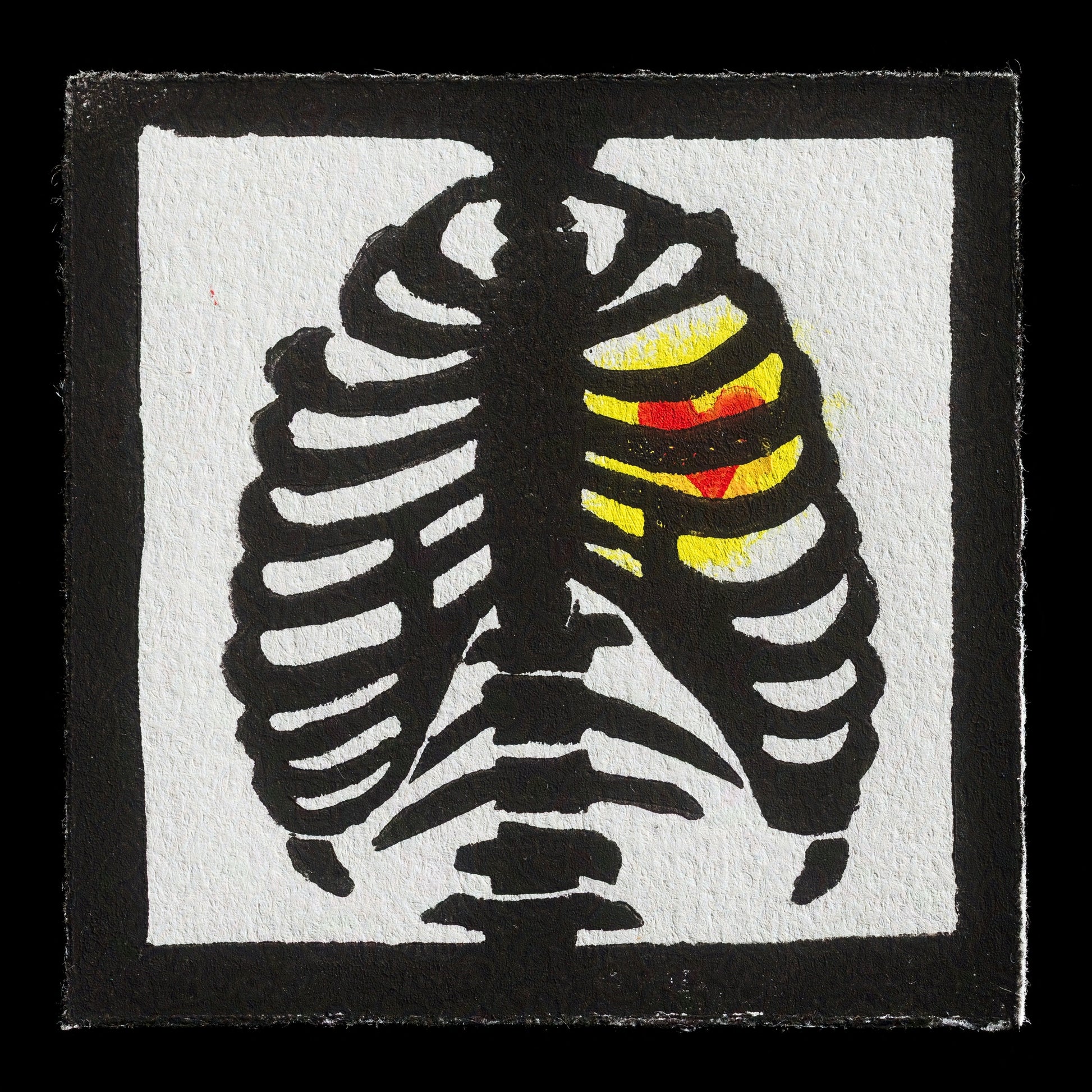 "1: Chest" by Alex Traurig